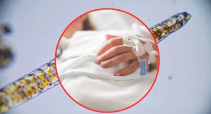 Yucatán suma 5 casos de gusano barrenador en humanos: ¿en qué municipios? | MAPA