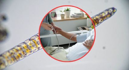 Confirman nuevo caso de gusano barrenador en humanos en Yucatán: ¿En qué municipio?