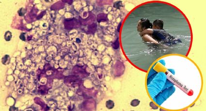 Brotes de Histoplasmosis en cenotes de Yucatán: ¿cómo evitar una infección durante las vacaciones?