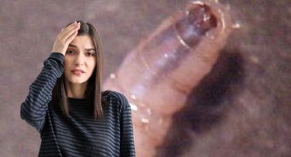 Reportan primer caso de gusano barrenador al oriente de Yucatán:¿cuántos contagios hay en el estado?