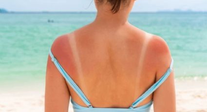 Cómo proteger tu piel del sol este verano: recomendaciones esenciales para cuidarte en Yucatán