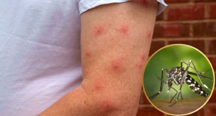 Día Internacional contra el Dengue: ¿qué es lo primero que debes hacer si te contagias?