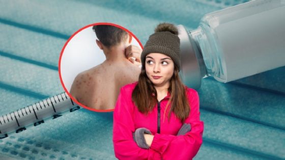 Sarampión en Yucatán: ¿qué personas ya NO deben aplicarse la vacuna?