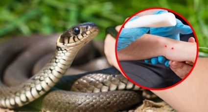 ¿Sabes qué hacer ante una mordedura de serpiente? SSY emite recomendaciones para salvar vidas