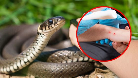 ¿Sabes qué hacer ante una mordedura de serpiente? SSY emite recomendaciones para salvar vidas